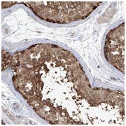 KAAG1, Rabbit, Polyclonal Antibody, Abnova 100&mu;L; Unlabeled:Antibodies,