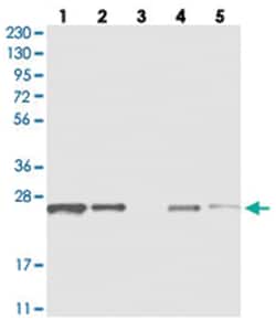 C1orf52, Rabbit, Polyclonal Antibody, Abnova 100 &mu;L | Buy Online | Abnova Corporation | Fisher Scientific