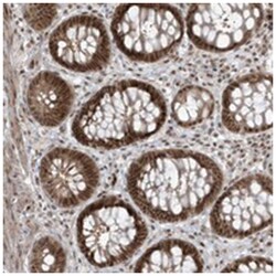 C1orf52, Rabbit, Polyclonal Antibody, Abnova 100 &mu;L | Buy Online | Abnova Corporation | Fisher Scientific