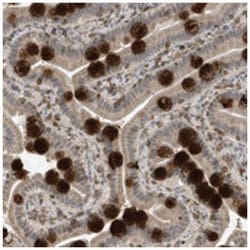 NSUN3, Rabbit, Polyclonal Antibody, Abnova 100&mu;L; Unlabeled:Antibodies,