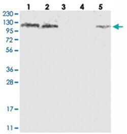 SKIV2L2, Rabbit, Polyclonal Antibody, Abnova 100&mu;L; Unlabeled:Antibodies,