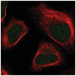 SKIV2L2, Rabbit, Polyclonal Antibody, Abnova 100&mu;L; Unlabeled:Antibodies,