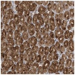 DULLARD, Rabbit, Polyclonal Antibody, Abnova 100 &mu;L | Buy Online | Abnova Corporation | Fisher Scientific