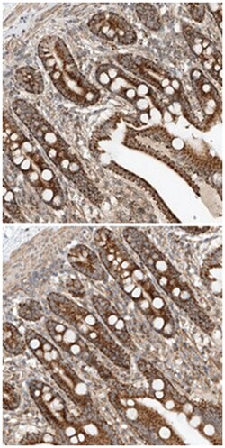 ADARB2, Rabbit, Polyclonal Antibody, Abnova 100&mu;L; Unlabeled:Antibodies,