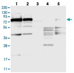 SRP72, Rabbit, Polyclonal Antibody, Abnova 100&mu;L; Unlabeled:Antibodies,