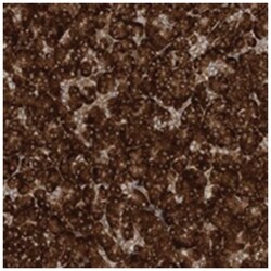 SRP72, Rabbit, Polyclonal Antibody, Abnova 100&mu;L; Unlabeled:Antibodies,