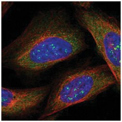 SRP72, Rabbit, Polyclonal Antibody, Abnova 100&mu;L; Unlabeled:Antibodies,
