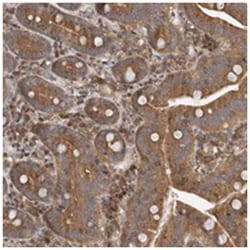 COLEC11, Rabbit, Polyclonal Antibody, Abnova 100&mu;L; Unlabeled:Antibodies,