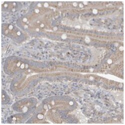 C1orf141, Rabbit, Polyclonal Antibody, Abnova 100 &mu;L | Buy Online | Abnova Corporation | Fisher Scientific