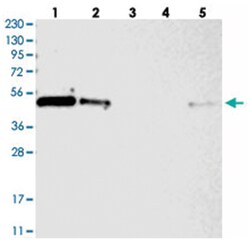 ZNF787, Rabbit, Polyclonal Antibody, Abnova 100&mu;L; Unlabeled:Antibodies,