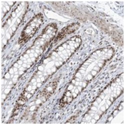 ZNF787, Rabbit, Polyclonal Antibody, Abnova 100&mu;L; Unlabeled:Antibodies,
