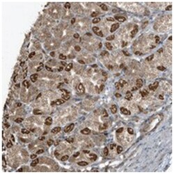 AZI2 Rabbit anti-Human, Polyclonal Antibody, Abnova 100 &mu;L | Buy Online | Abnova Corporation | Fisher Scientific