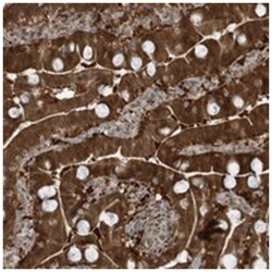 LRRC48, Rabbit, Polyclonal Antibody, Abnova 100 &mu;L | Buy Online | Abnova Corporation | Fisher Scientific