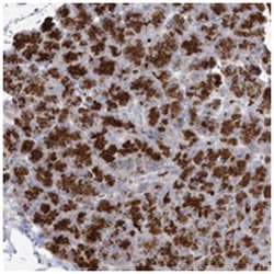 LOC150763, Rabbit, Polyclonal Antibody, Abnova 100 &mu;L | Buy Online | Abnova Corporation | Fisher Scientific