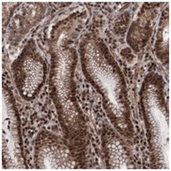 EYA4 Rabbit anti-Human, Polyclonal Antibody, Abnova 100 &mu;L | Buy Online | Abnova Corporation | Fisher Scientific