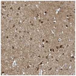 NCOA7 Rabbit anti-Human, Polyclonal Antibody, Abnova 100 &mu;L | Buy Online | Abnova Corporation | Fisher Scientific