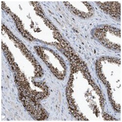 IBA57, Rabbit, Polyclonal Antibody, Abnova 100μL; Unlabeled:Antibodies,