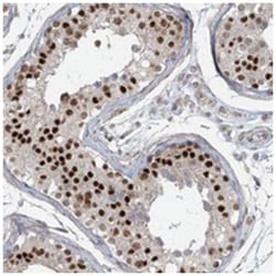 ZNF711, Rabbit, Polyclonal Antibody, Abnova 100 &mu;L | Buy Online | Abnova Corporation | Fisher Scientific