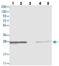 PMM1, Rabbit, Polyclonal Antibody, Abnova 100 &mu;L | Buy Online | Abnova Corporation | Fisher Scientific