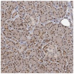 PMM1, Rabbit, Polyclonal Antibody, Abnova 100 &mu;L | Buy Online | Abnova Corporation | Fisher Scientific