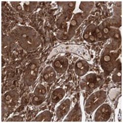 MDFIC, Rabbit, Polyclonal Antibody, Abnova 100&mu;L; Unlabeled:Antibodies,