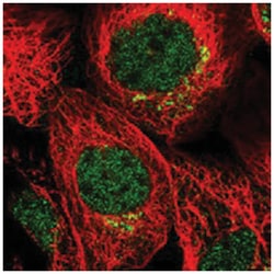 MDFIC, Rabbit, Polyclonal Antibody, Abnova 100&mu;L; Unlabeled:Antibodies,