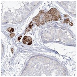 ZNF843, Rabbit, Polyclonal Antibody, Abnova 100&mu;L; Unlabeled:Antibodies,