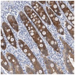 SH3YL1 Rabbit anti-Human, Polyclonal Antibody, Abnova 100 &mu;L | Buy Online | Abnova Corporation | Fisher Scientific