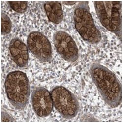 LGSN, Rabbit, Polyclonal Antibody, Abnova 100&mu;L; Unlabeled:Antibodies,