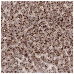 TACC2, Rabbit, Polyclonal Antibody, Abnova 100 &mu;L | Buy Online | Abnova Corporation | Fisher Scientific