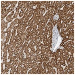 OFD1 Rabbit anti-Human, Polyclonal Antibody, Abnova 100&mu;L; Unlabeled:Antibodies,