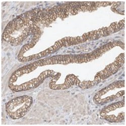 OFD1 Rabbit anti-Human, Polyclonal Antibody, Abnova 100&mu;L; Unlabeled:Antibodies,