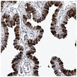 RSHL3 Rabbit anti-Human, Polyclonal Antibody, Abnova 100&mu;L; Unlabeled:Antibodies,