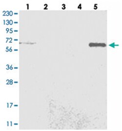 C6orf190, Rabbit, Polyclonal Antibody, Abnova 100 &mu;L | Buy Online | Abnova | Fisher Scientific