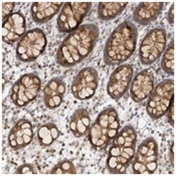 C6orf190, Rabbit, Polyclonal Antibody, Abnova 100 &mu;L | Buy Online | Abnova | Fisher Scientific