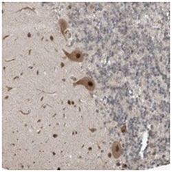 C2orf30 Rabbit anti-Human, Polyclonal Antibody, Abnova 100 &mu;L | Buy Online | Abnova Corporation | Fisher Scientific