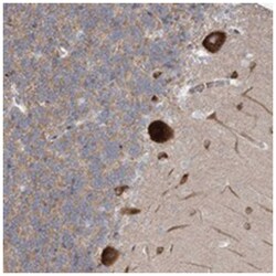 TTBK1 Rabbit anti-Human, Polyclonal Antibody, Abnova 100&mu;L; Unlabeled:Antibodies,