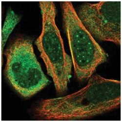 BCORL1 Rabbit anti-Human, Polyclonal Antibody, Abnova 100&mu;L; Unlabeled:Antibodies,