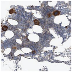 NALCN Rabbit anti-Human, Polyclonal Antibody, Abnova 100 &mu;L | Buy Online | Abnova Corporation | Fisher Scientific