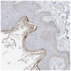 KPRP, Rabbit, Polyclonal Antibody, Abnova 100 &mu;L | Buy Online | Abnova Corporation | Fisher Scientific