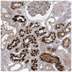 MMGT1, Rabbit, Polyclonal Antibody, Abnova 100 &mu;L | Buy Online | Abnova Corporation | Fisher Scientific