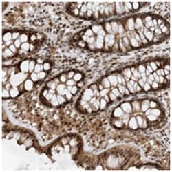 TATDN3, Rabbit, Polyclonal Antibody, Abnova 100 &mu;L | Buy Online | Abnova Corporation | Fisher Scientific