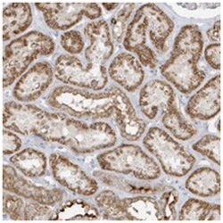 UHRF1BP1 Rabbit anti-Human, Polyclonal Antibody, Abnova 100 &mu;L | Buy Online | Abnova Corporation | Fisher Scientific