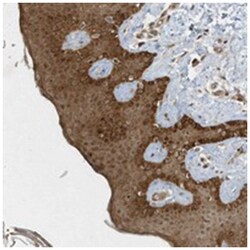 C6orf106, Rabbit, Polyclonal Antibody, Abnova 100&mu;L; Unlabeled:Antibodies,