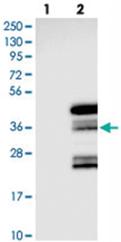 C6orf106, Rabbit, Polyclonal Antibody, Abnova 100&mu;L; Unlabeled:Antibodies,