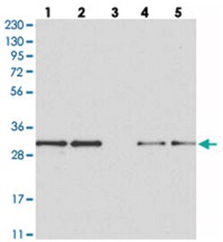 MAPK1IP1L, Rabbit, Polyclonal Antibody, Abnova 100 &mu;L | Buy Online | Abnova Corporation | Fisher Scientific