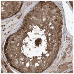 MAPK1IP1L, Rabbit, Polyclonal Antibody, Abnova 100 &mu;L | Buy Online | Abnova Corporation | Fisher Scientific
