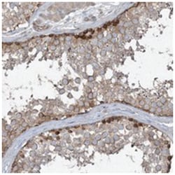 PKDREJ, Rabbit, Polyclonal Antibody, Abnova 100 &mu;L | Buy Online | Abnova Corporation | Fisher Scientific