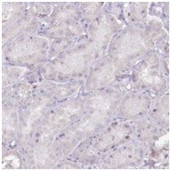 C10orf35, Rabbit, Polyclonal Antibody, Abnova 100 &mu;L | Buy Online | Abnova Corporation | Fisher Scientific