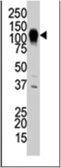 MAP3K6, Rabbit, Polyclonal Antibody, Abnova 400 &mu;L | Buy Online | Abnova Corporation | Fisher Scientific